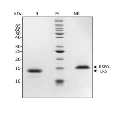 RUO Recombinant Human HGF (NK1) protein