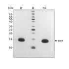 RUO Recombinant Human BDNF Protein